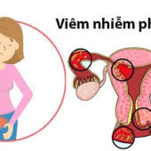viem-am-dao-do-dau-nhung-dau-hieu-nhan-biet-cua-benh-viem-phu-khoa
