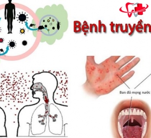 Bệnh Lý Truyền Nhiễm